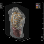 Midjourney Ultrasonic CT. The AI image-maker builds a hot tub that scans you