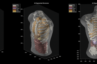 Midjourney Ultrasonic CT. The AI image-maker builds a hot tub that scans you