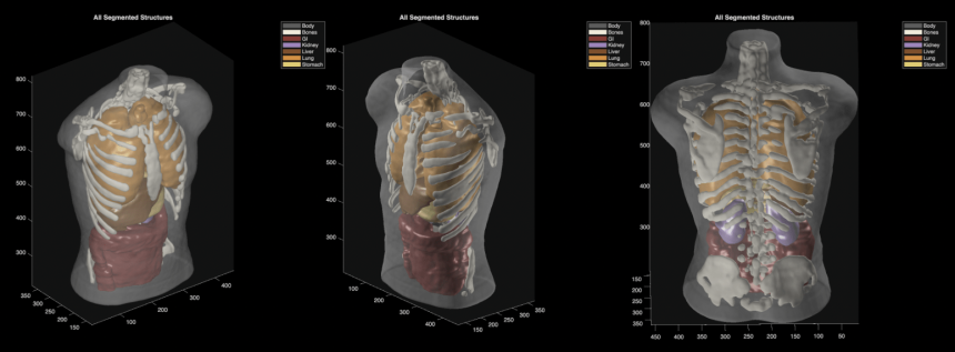Midjourney Ultrasonic CT. The AI image-maker builds a hot tub that scans you